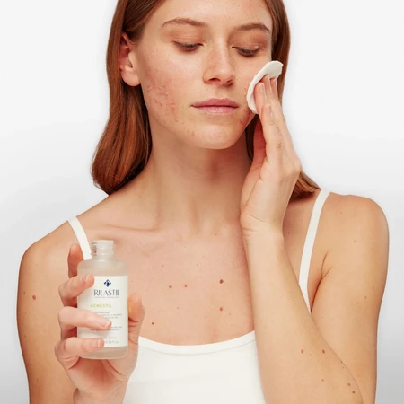 Acnestil Micropeelingové exfoliačné mlieko na problematickú pleť
