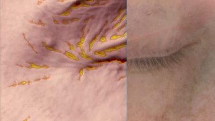 Porovnanie pred a po aplikácii