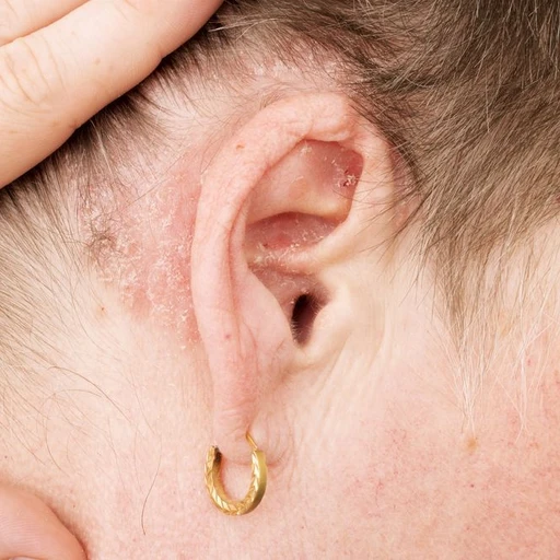 4a079562c43b49e418fa76a6fa91dcf7